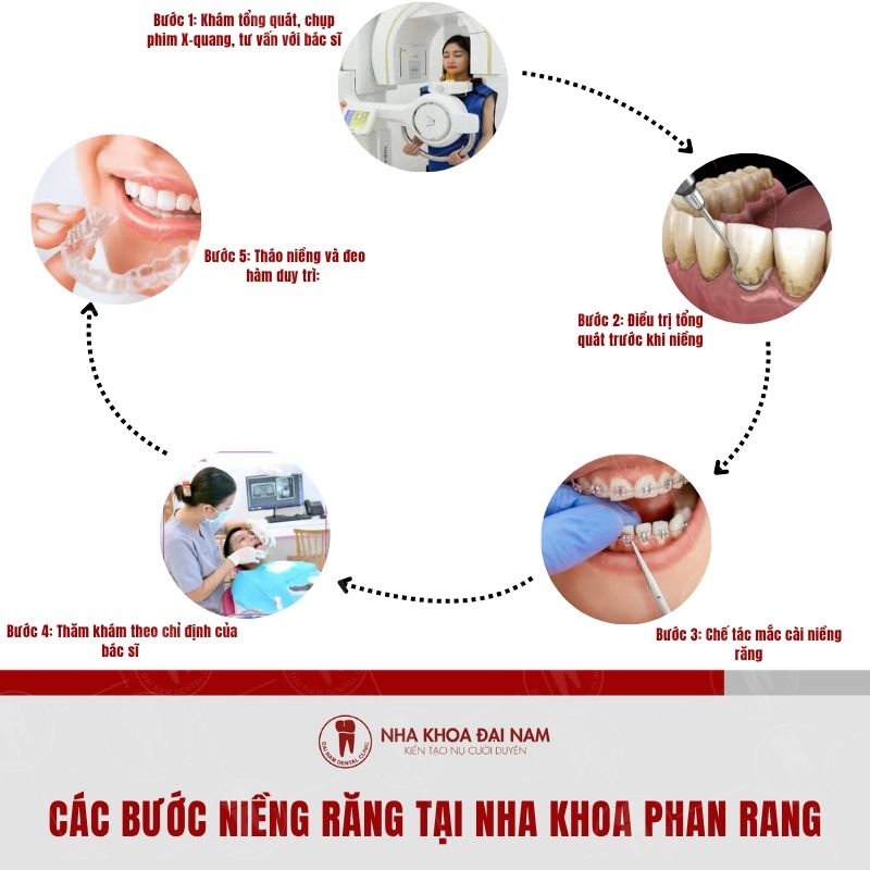 Cac buoc nieng rang o Dai Nam Phan Rang