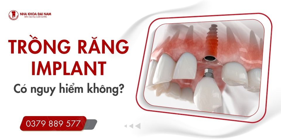 Trồng răng Implant có nguy hiểm không? Nha khoa Đại Nam