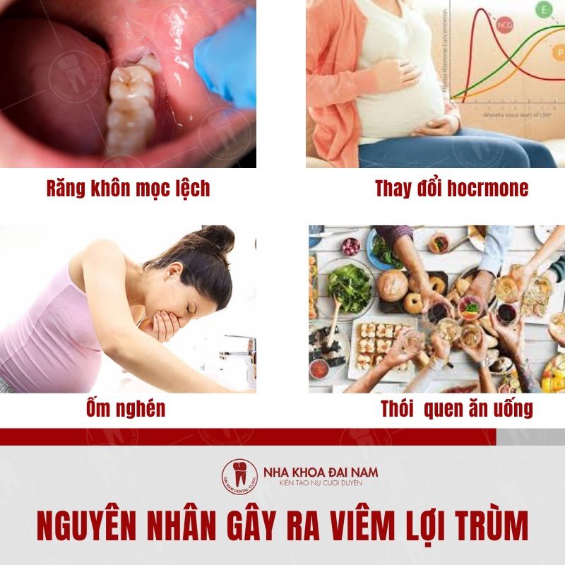 Tinh trang viem loi trum thuong do rat nhieu nguyen nhan gay ra