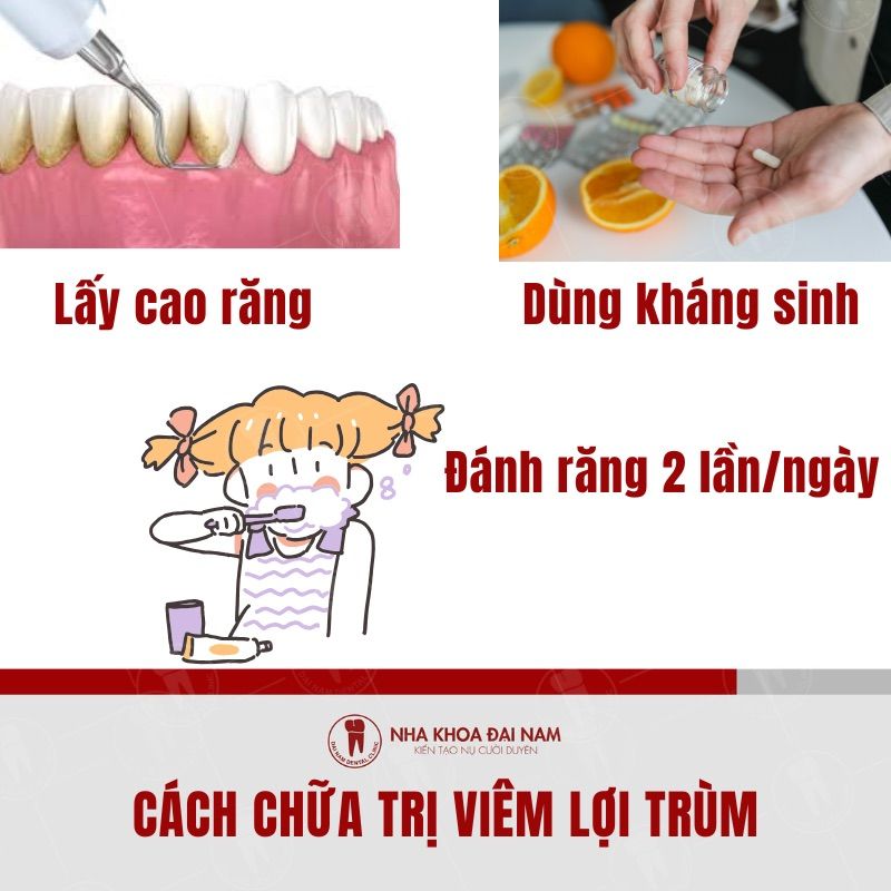 Nhung phuong phap se giup dieu tri viem loi trum