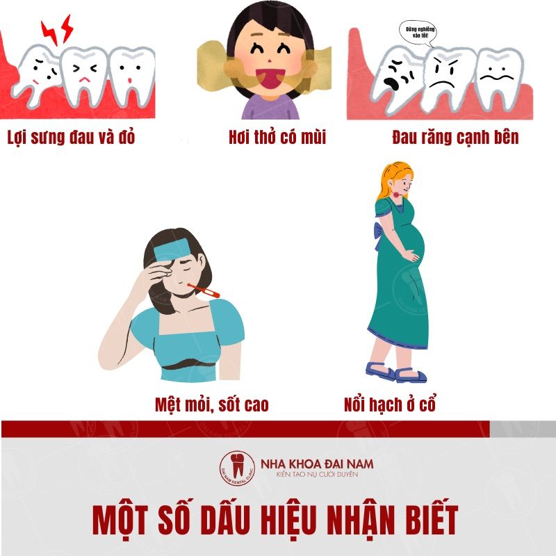 Neu gap nhung dau hieu nay chung ta can den nha si som nhat de dieu tri som nhat