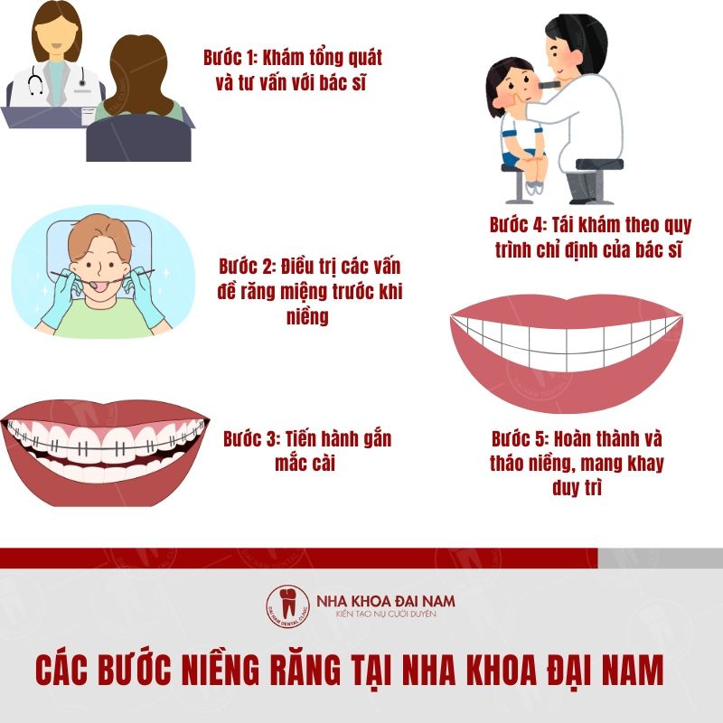 Quy trinh nieng rang tai He thong Nha Khoa Dai Nam