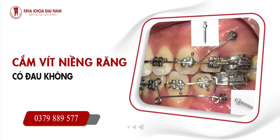 Cam vit nieng rang co dau khong