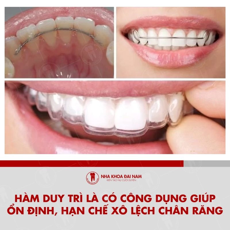 Ham duy tri co cong dung giup on dinh han che xo lech chan rang