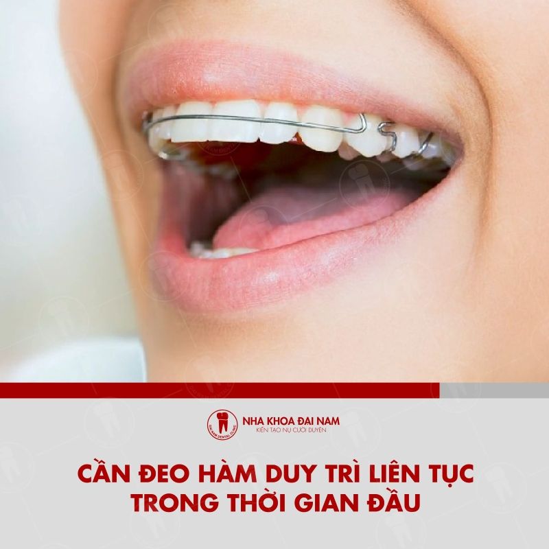 Can deo ham duy tri lien tuc trong thoi gian dau