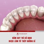 Ham duy tri co dinh duoc gan vao mat trong cua rang sau khi thao nieng