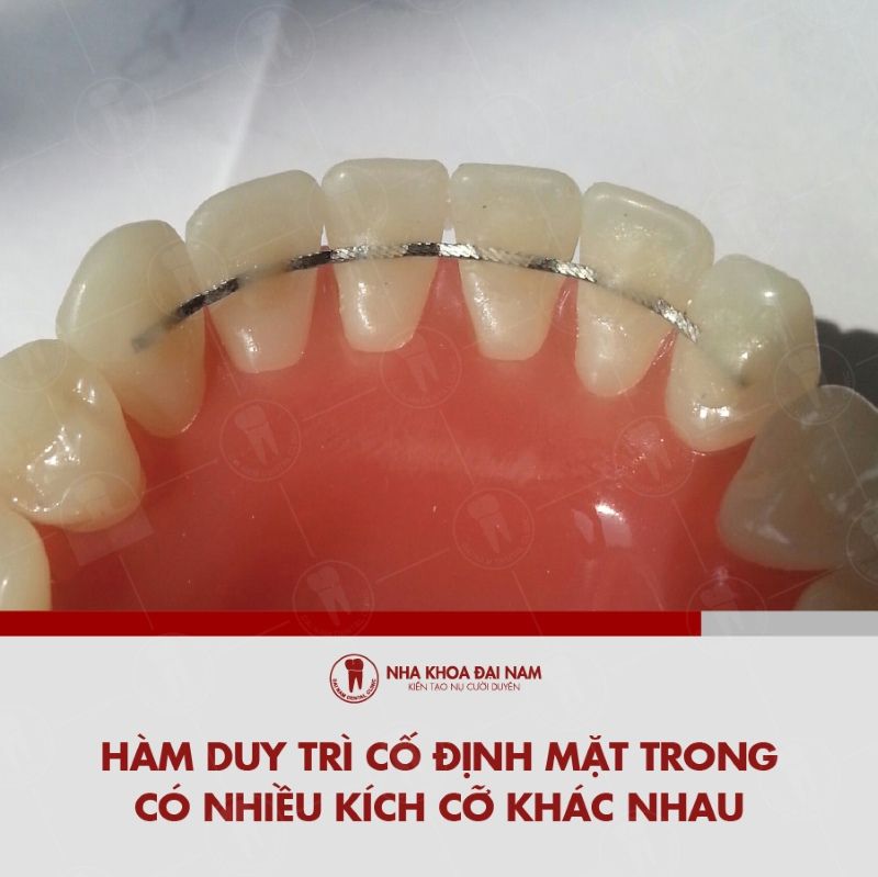 Khi cu co dinh mat trong co hieu qua vuot troi