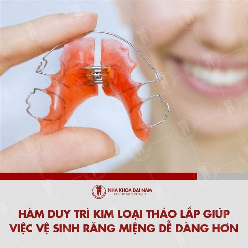 Ham duy tri kim loai thao lap co su tien loi linh hoat trong qua trinh su dung