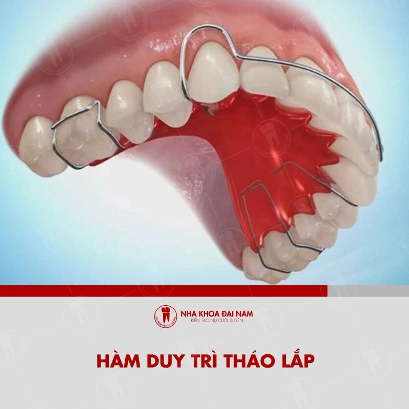 Ham duy tri thao lap duoc lam tu day kim loai cung chac ket hop voi phan nen nhua om sat cung rang