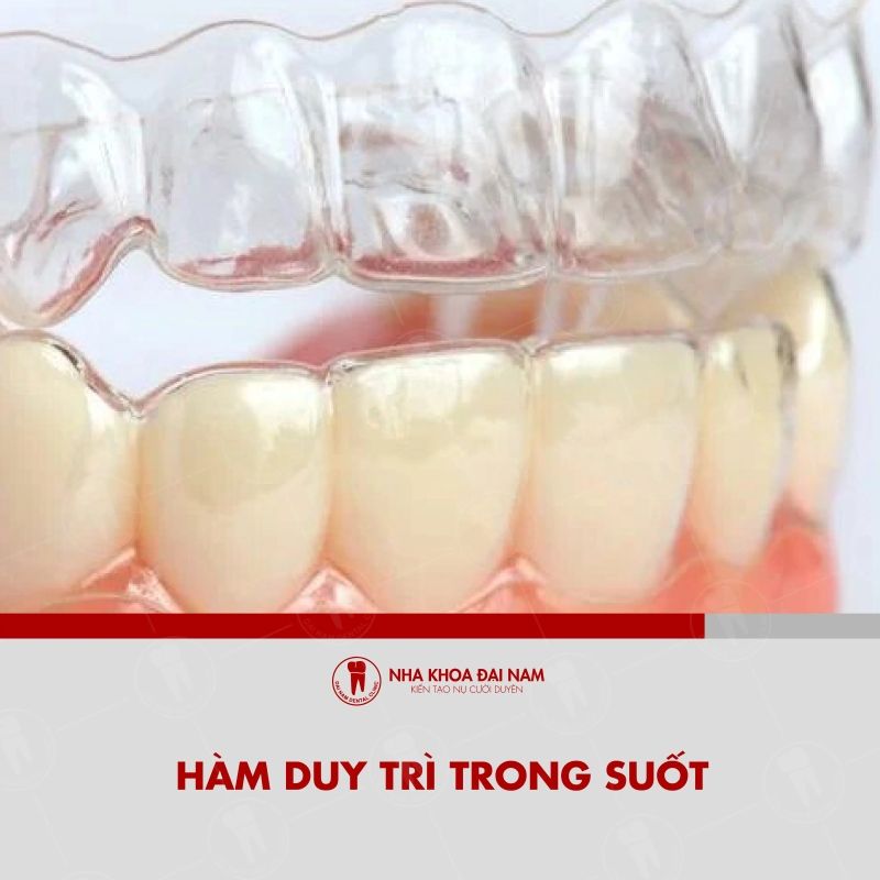Ham duy tri trong suot duoc che tao tu nhua y te trong suot om sat toan bo ham rang