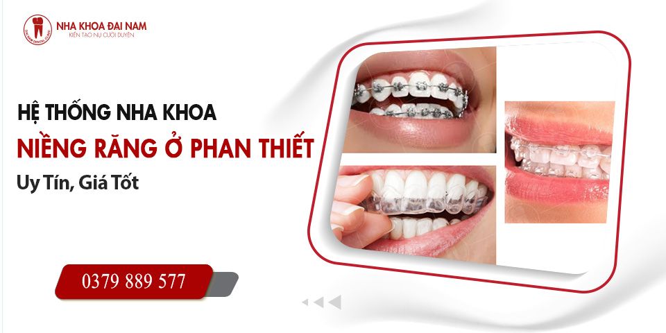 Hệ thống nha khoa niềng răng ở Phan Thiết uy tín, giá tốt