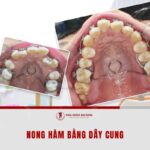Su dung luc tu day cung giup mo rong khung ham