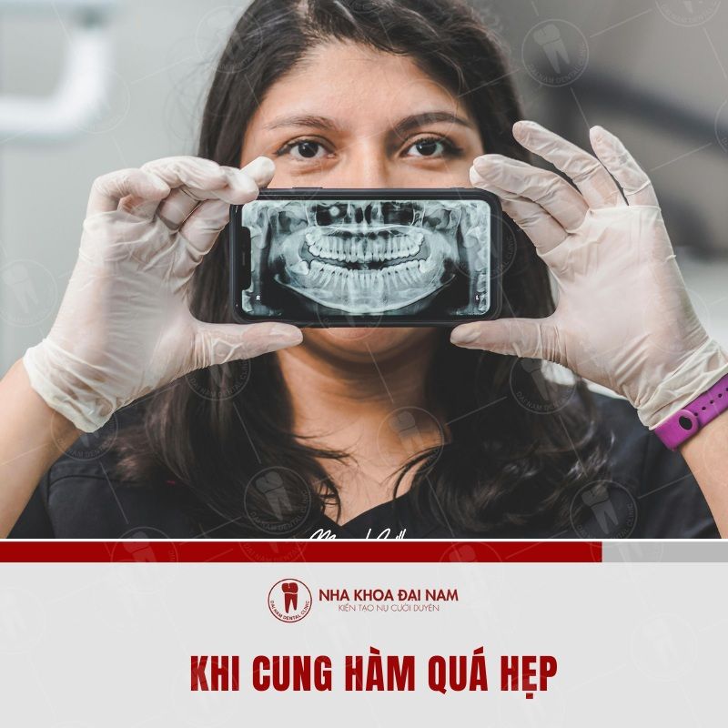 Nong ham khi cung ham qua hep