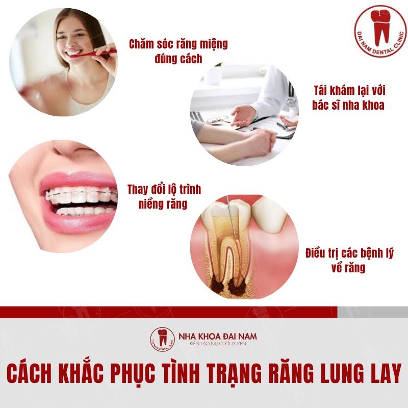  Giai phap khac phuc tinh trang rang lung lay 