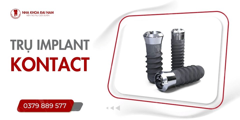 TRỤ IMPLANT KONTACT CÓ TỐT KHÔNG? GIÁ BAO NHIÊU?