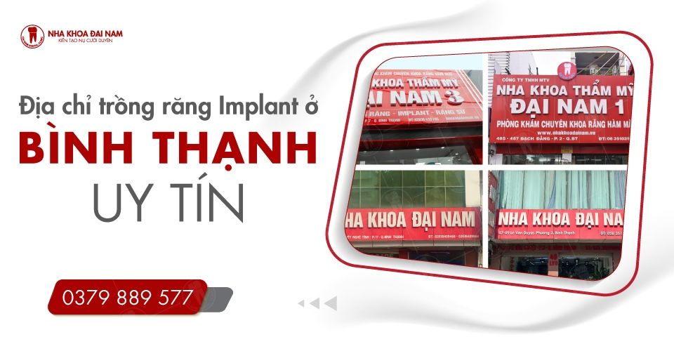 Địa chỉ nha khoa Trồng răng Implant ở Bình Thạnh uy tín