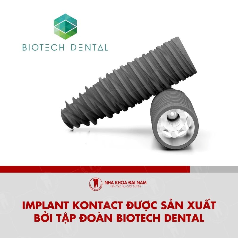 Tru Implant Kontact duoc san xuat boi Tap doan Biotech Dental