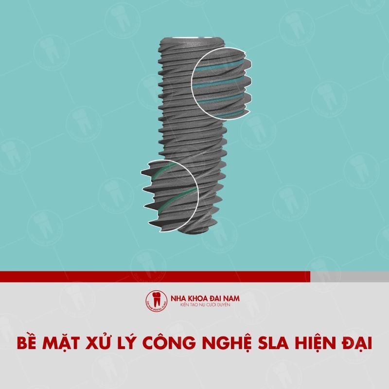 Tru Implant Kontact duoc ung dung cong nghe xu ly be mat SLA