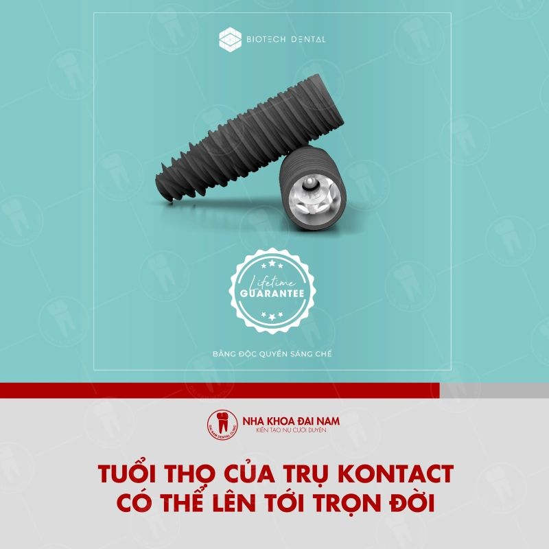 Tuoi tho cua tru Kontact co the len den tron doi