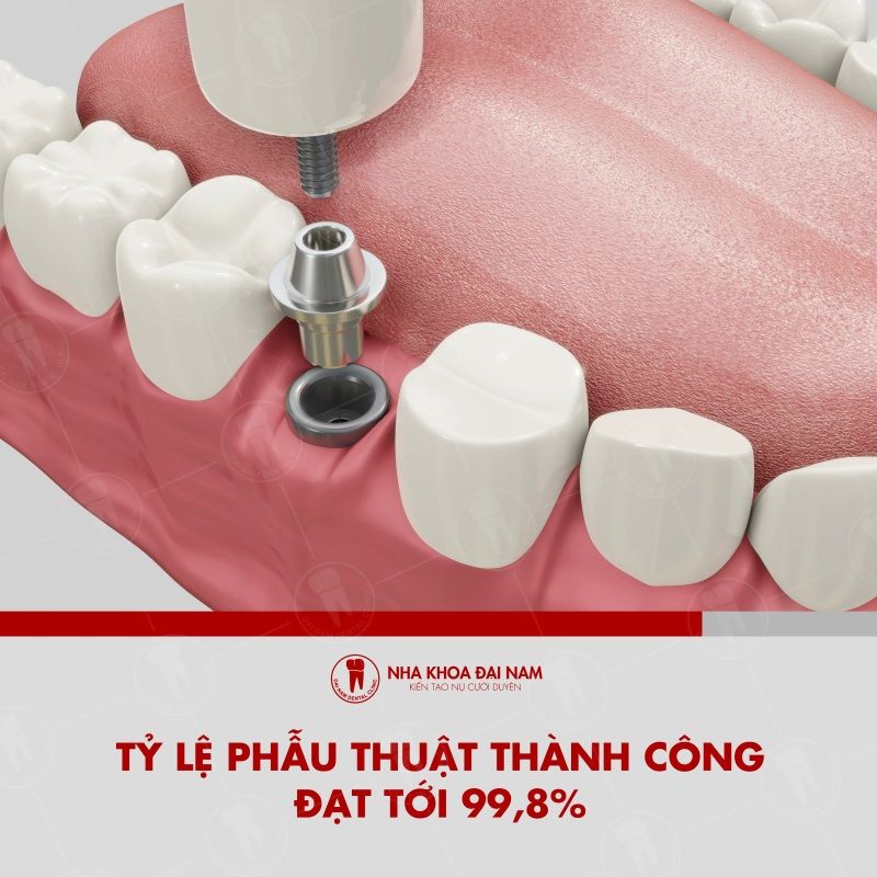 Thiet ke toi uu ty le thanh cong cao